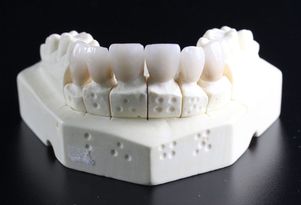 model of a denture