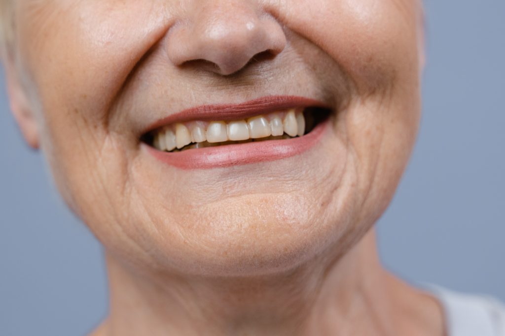 person with fresh set of teeth